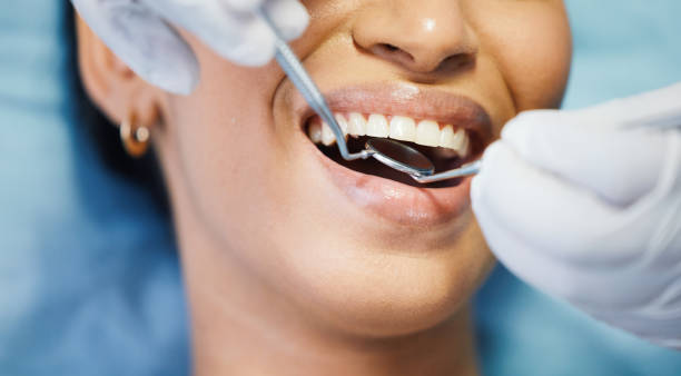 Best Emergency Dental Care for Abscessed Tooth in North Royalton, OH