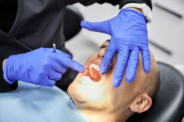 Best Emergency Dental Extractions in North Royalton, OH