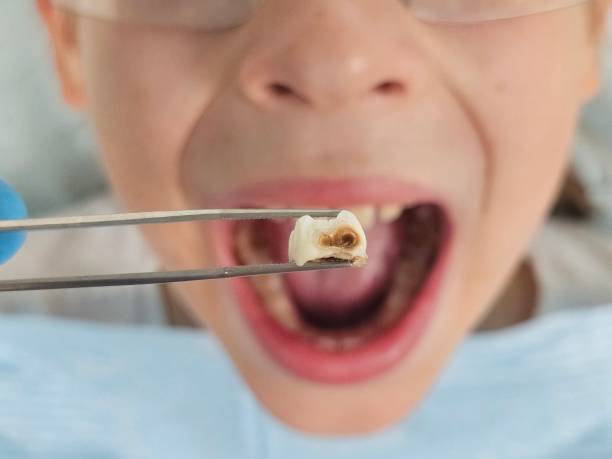 Best Orthodontic Emergency Dentist in North Royalton, OH